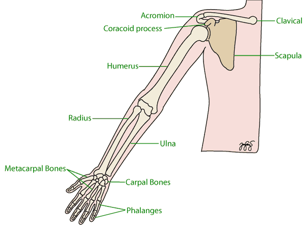 broken arm